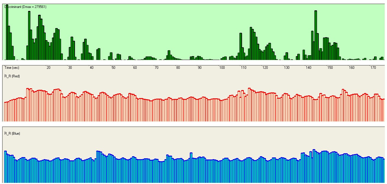 LifePulsePro+. Two hearts module. Discriminant