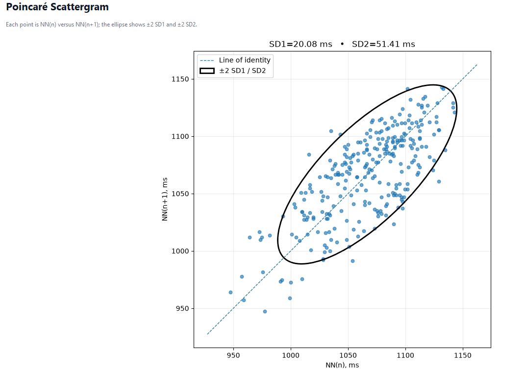 Poincare scattergram with SD1 and SD2