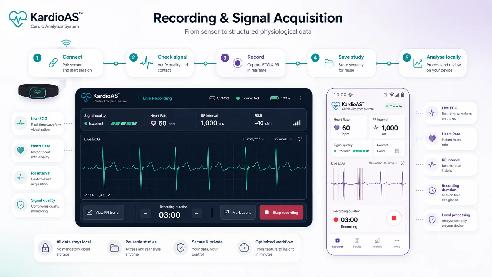 KardioAS recording and signal acquisition workflow