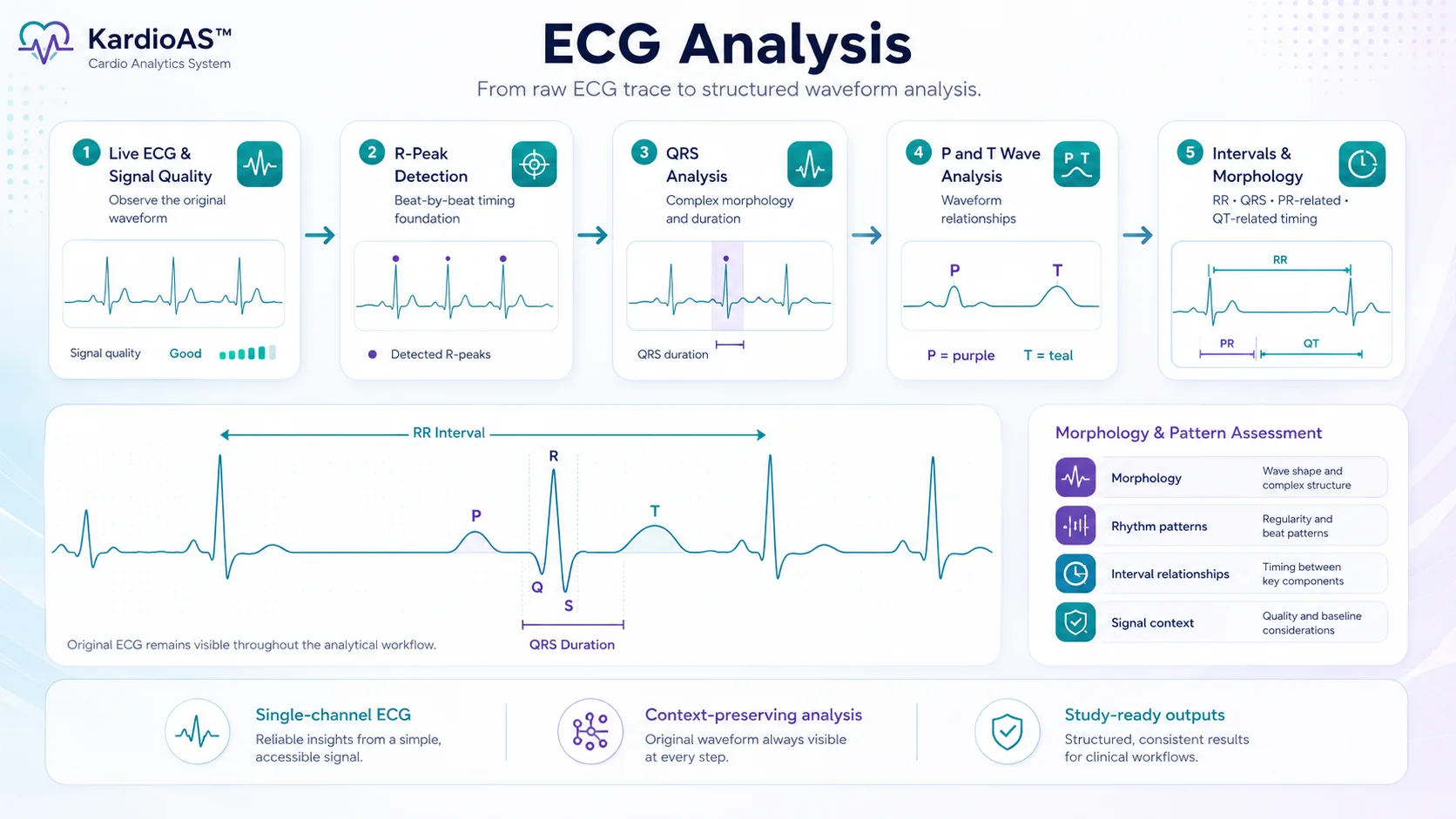 Kardio·AS ECG analysis workflow with R, QRS, P and T markers