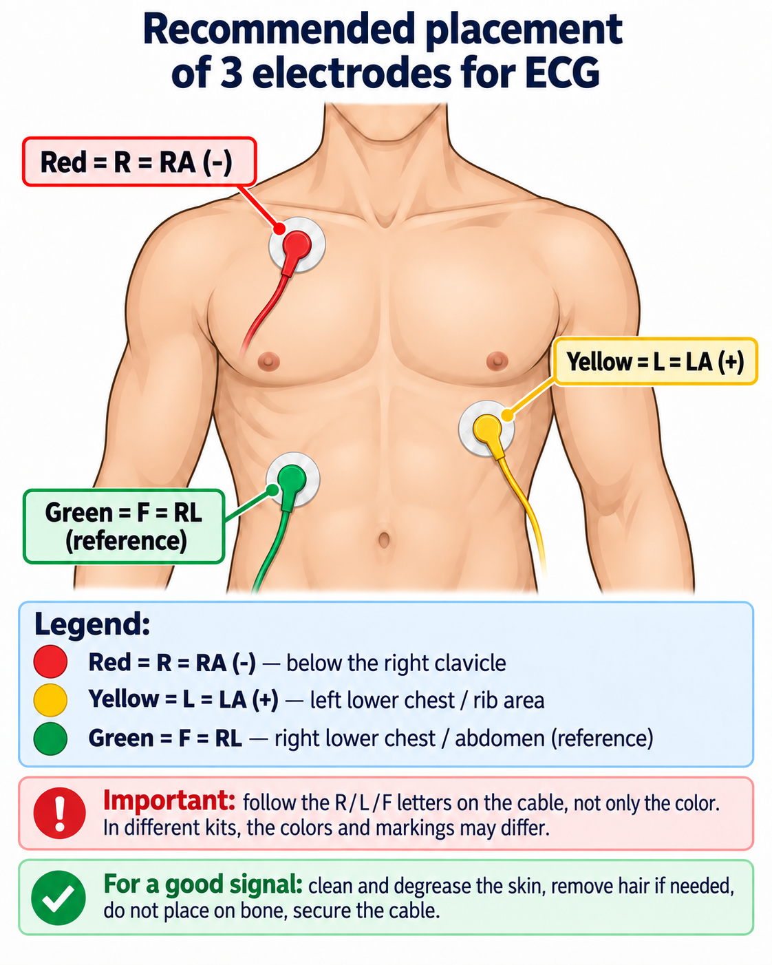 Recommended placement of three ECG electrodes: red RA negative, yellow LA positive and green RL reference.
