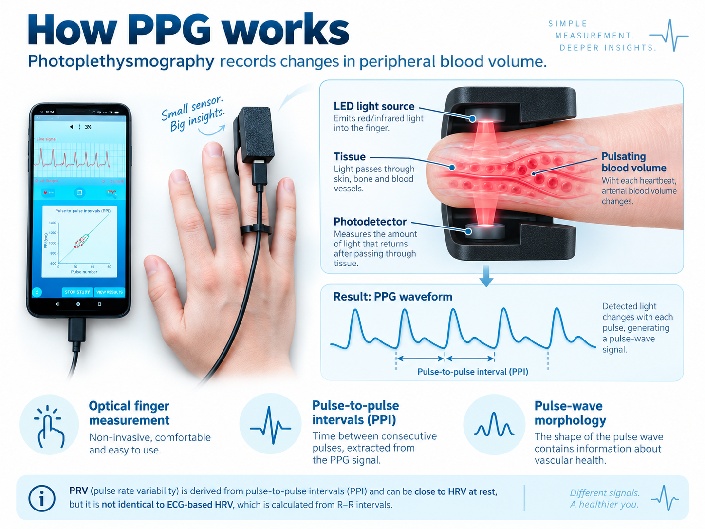 How photoplethysmography works: finger sensor, light source, photodetector, pulse-to-pulse intervals and PPG waveform.