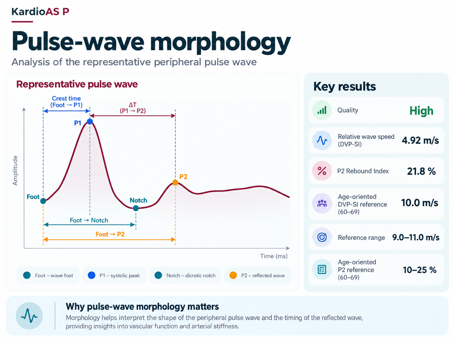 KardioAS P pulse-wave morphology infographic with Foot, P1, Notch, P2 and timing measurements.